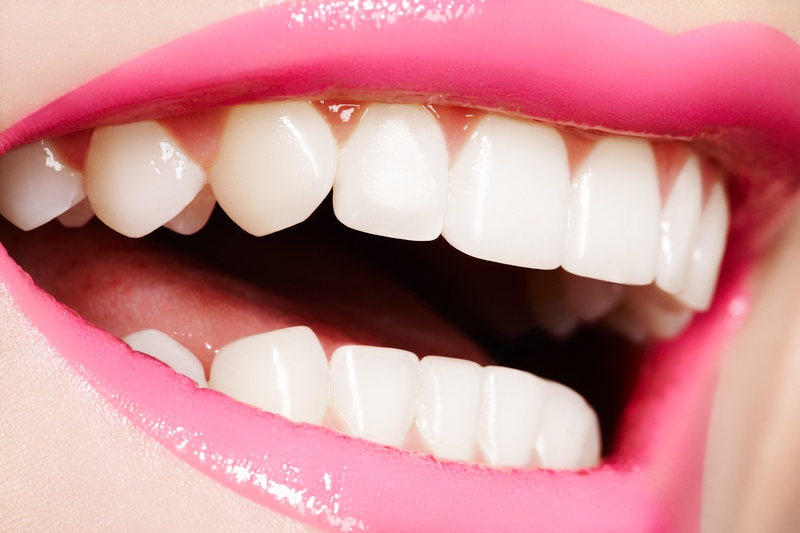 estetica-dental-en-alcobendas
