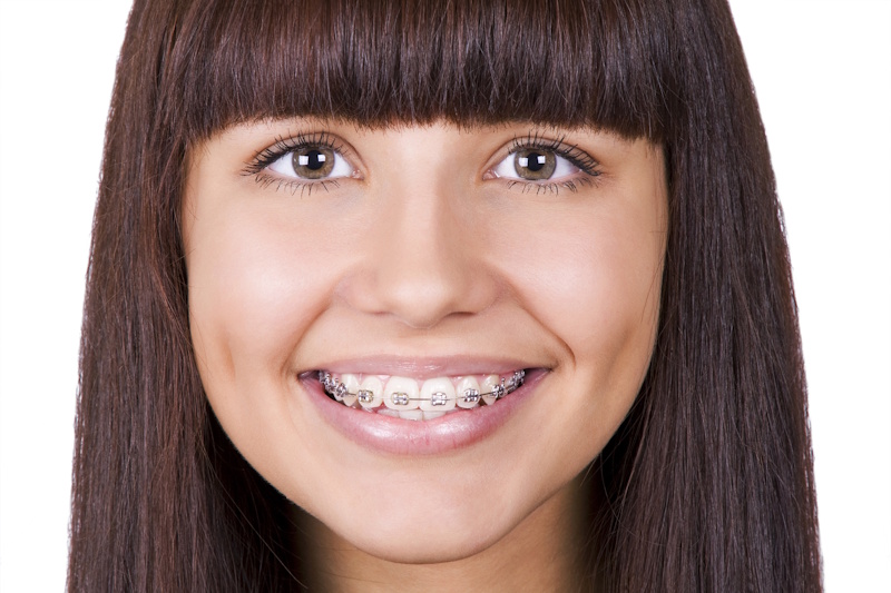 ortodoncia-en-alcobendas